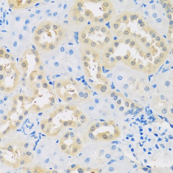 LETMD1 Antibody