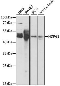 NDRG1 Antibody
