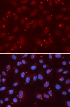 XRCC3 Antibody