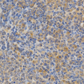 PRKCE Antibody