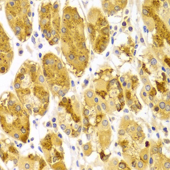 PRKCE Antibody