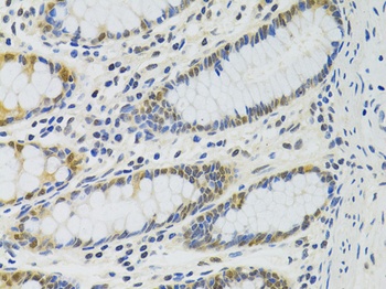 PPP4C Antibody