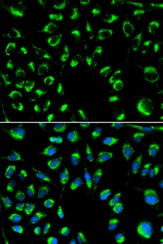 PPP4C Antibody