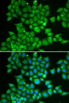 PDE1B Antibody