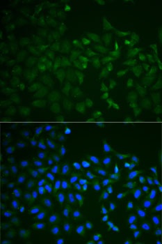 TNFRSF11B Antibody