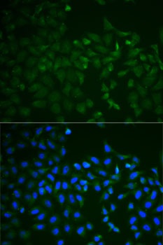 TNFRSF11B Antibody