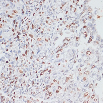 Ki67 Antibody