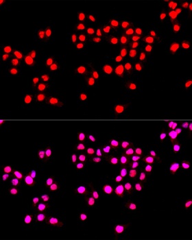 Ki67 Antibody