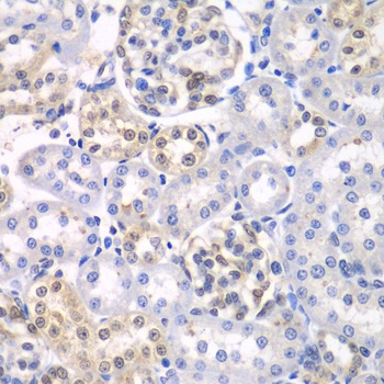 HDAC2 Antibody