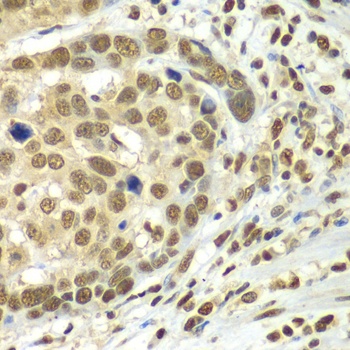 HDAC2 Antibody