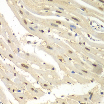 HDAC2 Antibody