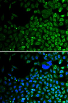 HDAC2 Antibody