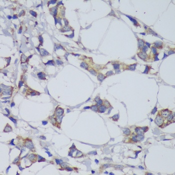 GSK3B Antibody