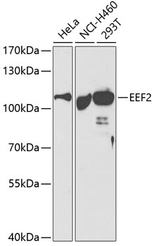 EEF2 Antibody