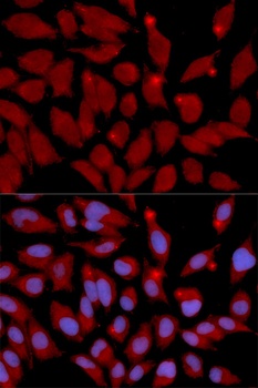 DNMT3A Antibody