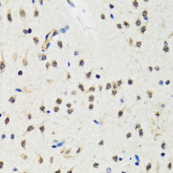 CHUK Antibody