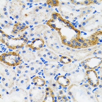 CHUK Antibody