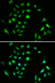 CHUK Antibody