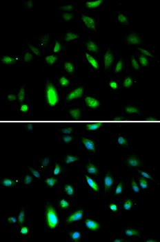 CCNB1 Antibody