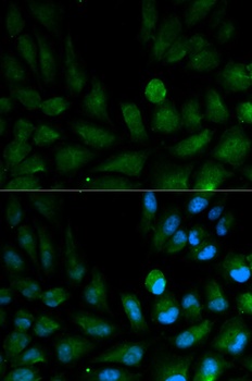 CAPZA2 Antibody