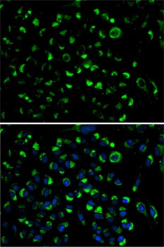AK4 Antibody