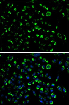 AK4 Antibody