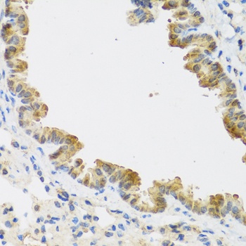 CDKN2C Antibody