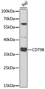 CD79B Antibody
