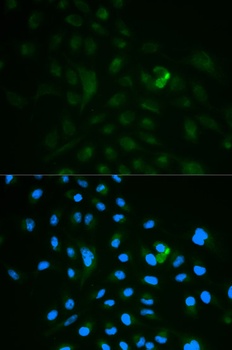 CD79B Antibody