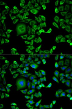 EXT1 Antibody