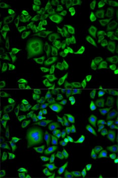 EXT1 Antibody