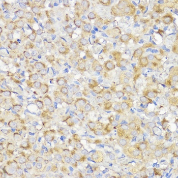 BMPR1B Antibody