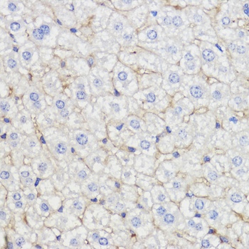 BMPR1B Antibody