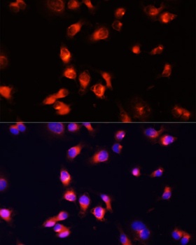 BMPR1B Antibody