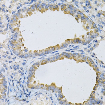 AP2B1 Antibody