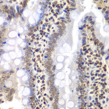 PSMC3 Antibody