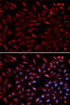 PSMC2 Antibody