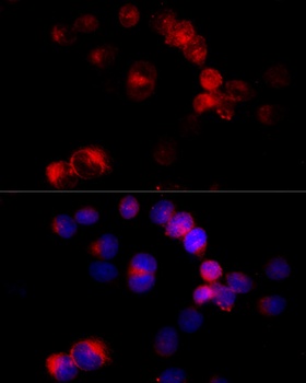 CYP27A1 Antibody