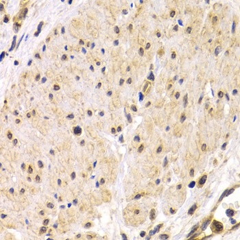 TMPRSS2 Antibody
