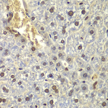 RPL5 Antibody