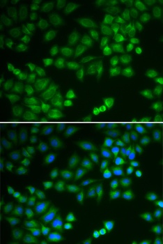 RPL5 Antibody