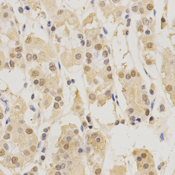 PSMB5 Antibody