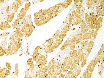 PLCB1 Antibody