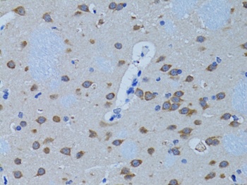 PLCB1 Antibody