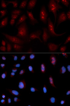 PLCB1 Antibody