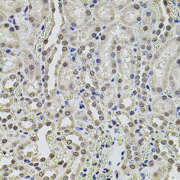 SMARCC2 Antibody