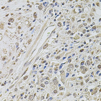 SMARCC2 Antibody