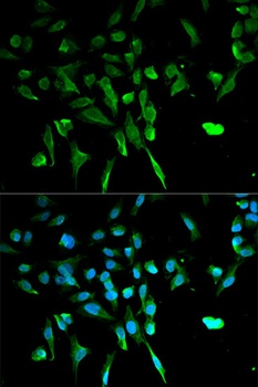 TRIM21 Antibody
