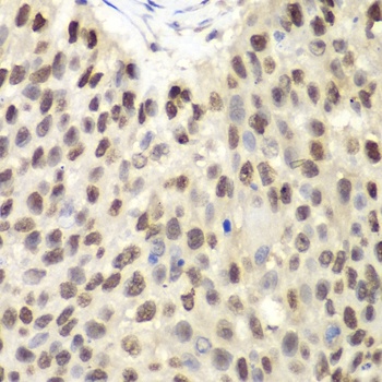 MCM6 Antibody