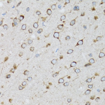 UBE2D1 Antibody